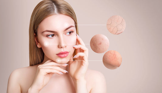 Syntol - A Probiotic Approach to Skin Health From Within
