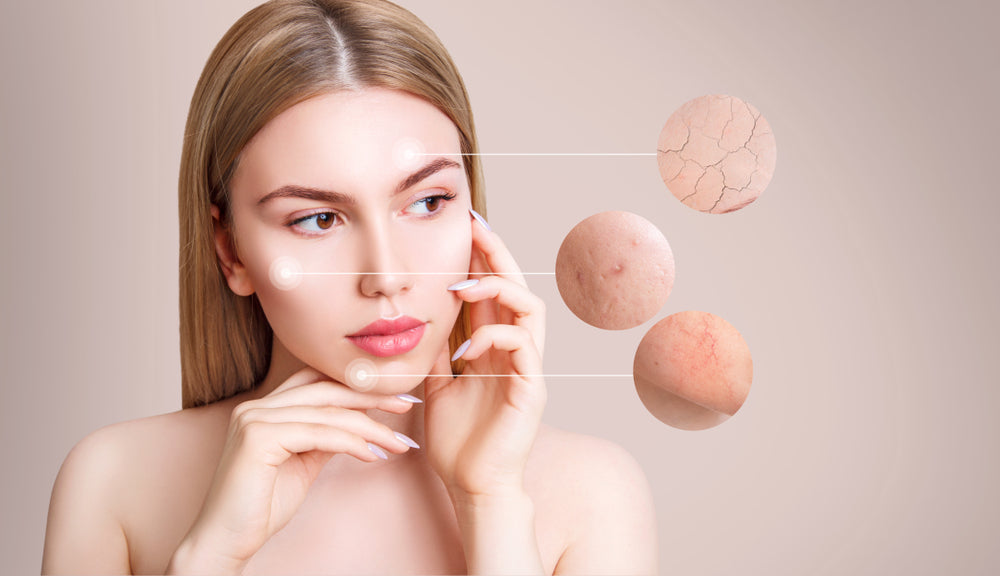 Syntol - A Probiotic Approach to Skin Health From Within